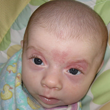 Why Does Your Baby Have Red Eyes? A Parents' Guide
